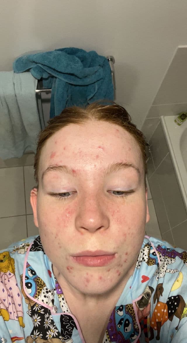 Hero Cosmetics Clarifying Prebiotic Moisturizer review photo by Lizzieeeee
