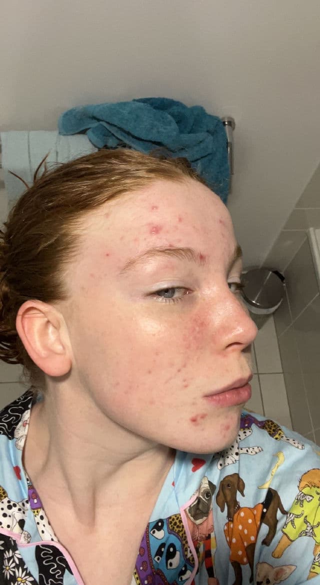 Hero Cosmetics Clarifying Prebiotic Moisturizer review photo by Lizzieeeee