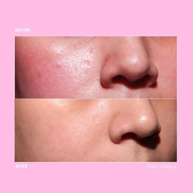 P.CALM Porsica Ampoule review photo by Corinaliz