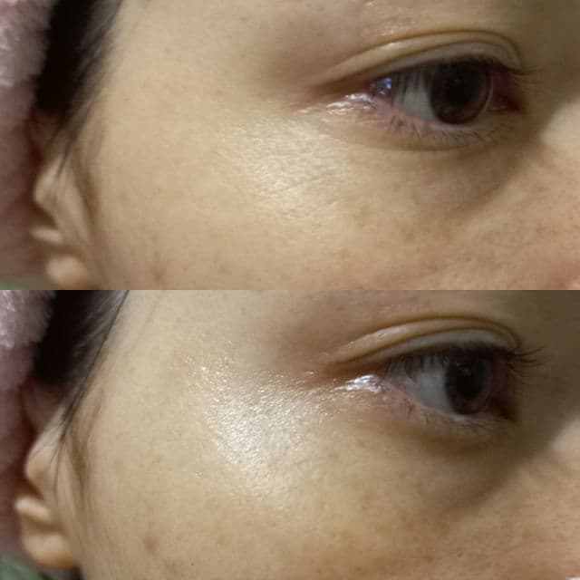 Mizon Pure Pearl Eye Gel Patch  review photo by valenshine