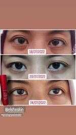 ElsheSkin 5 in 1 Eyessential Night Serum review photo by kikyisnaeni12