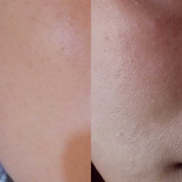 Isoi isoi Bulgarian Rose Blemish Care Mask 10 Sheets review photo by kikyisnaeni12