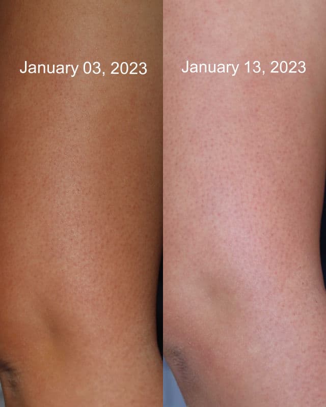 Auau Vitamin Whitening Moisture Cream review photo by mochiface