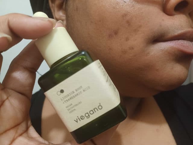 Viegano Licorice Root + Tranexamic Acid	 review photo by fatbaebie