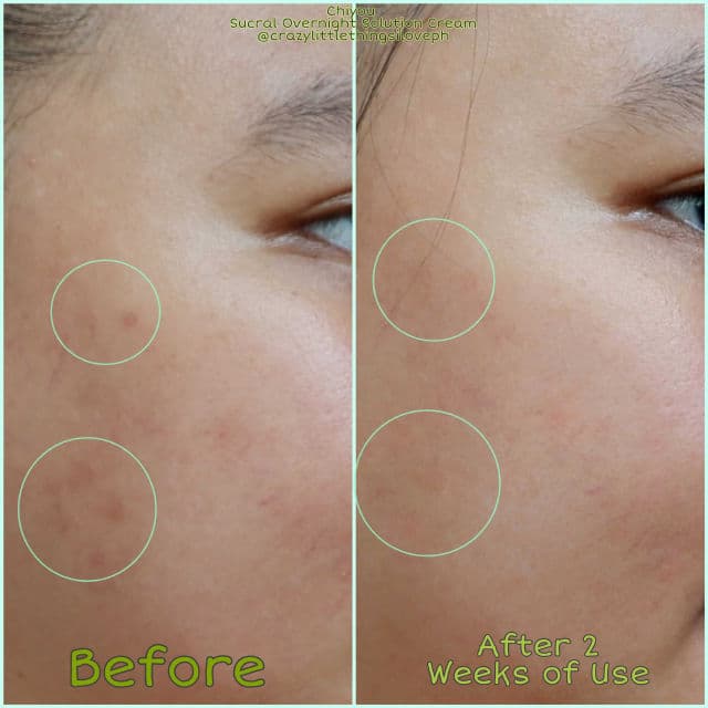 CHIYOU Sucral Overnight Solution Cream review photo by CLThingsiLove
