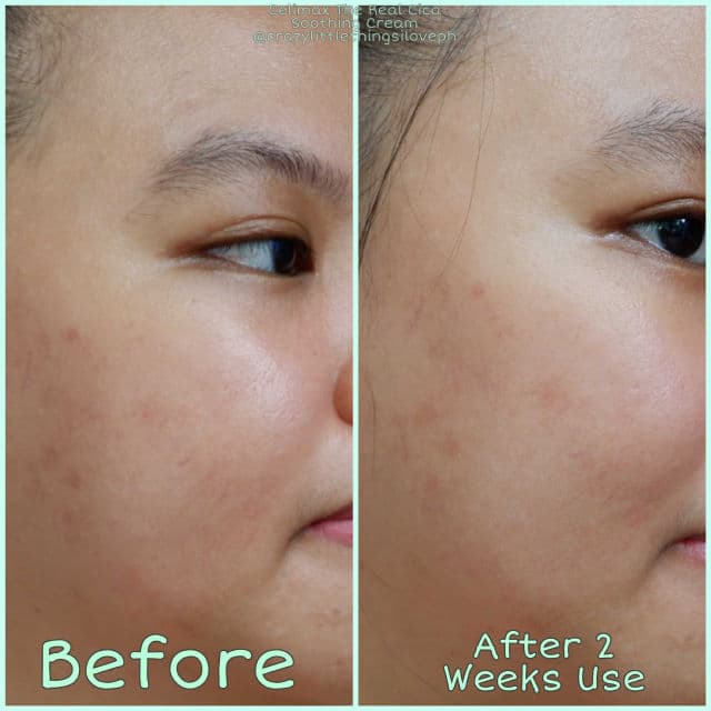 CELIMAX The Real Cica Soothing Cream  review photo by CLThingsiLove