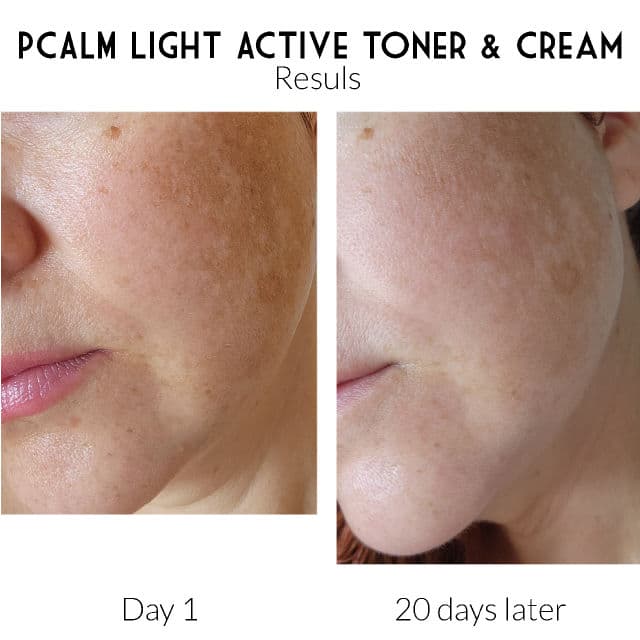 P.CALM Light Active Cream review photo by Kat573