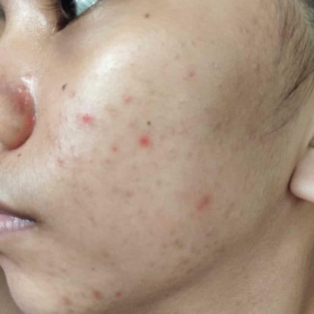 SKIN1004 Madagascar Centella Ampoule review photo by bunnybun