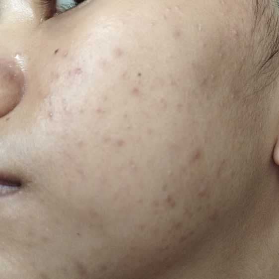 Celeteque Hydration Facial Moisturizer review photo by bunnybun