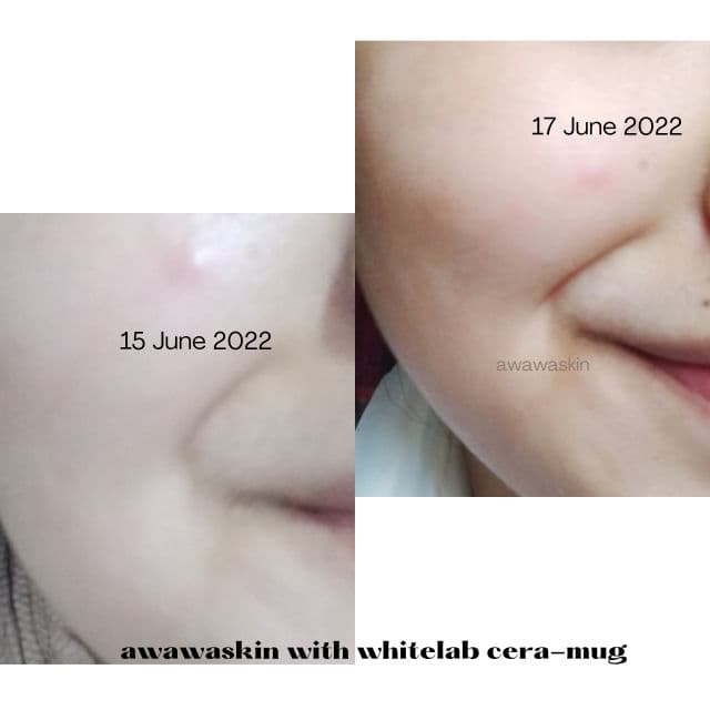 whitelab Cera-Mug Barrier Moisturizing Gel review photo by awawaskin