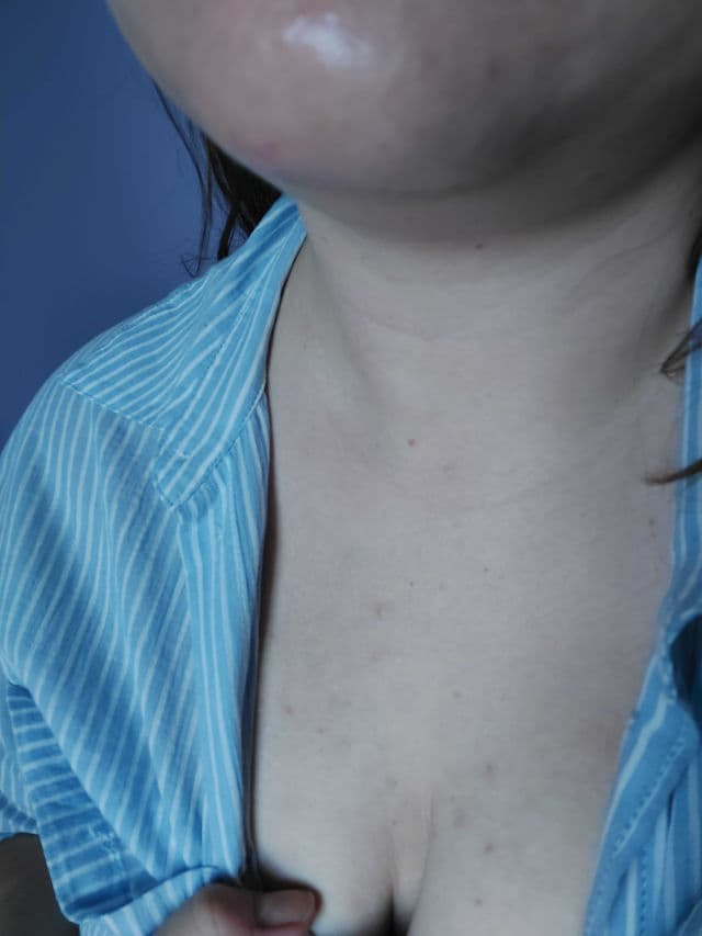 Balance Me PHA Clarifying Mist review photo by picmejker
