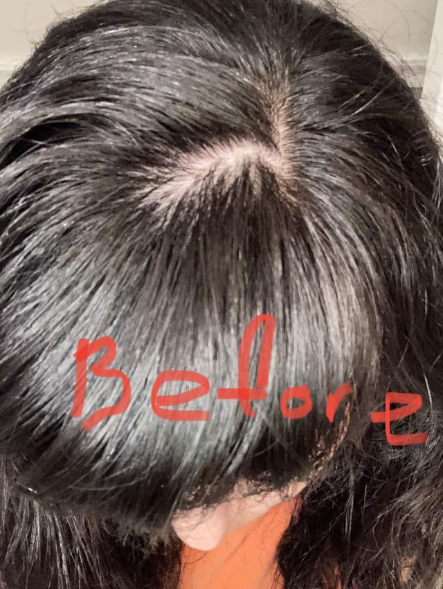 The Ordinary Multi-Peptide Serum for Hair Density review photo by SashaMoon