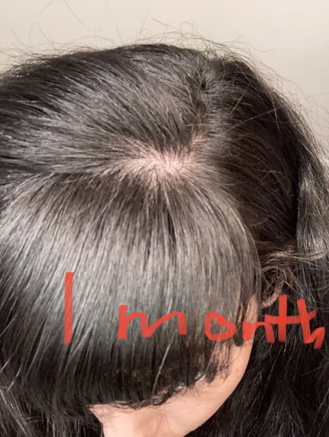 The Ordinary Multi-Peptide Serum for Hair Density review photo by SashaMoon