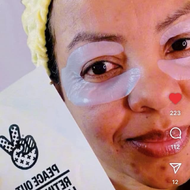 Peace Out Retinol Eye Lift Patches review photo by Lingua