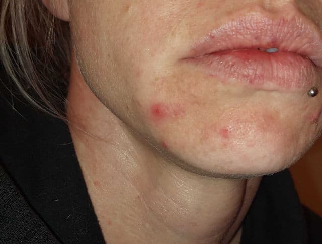 Nip + Fab Salicylic Fix Gel Cleanser review photo by LuvSkincareAndBeauty