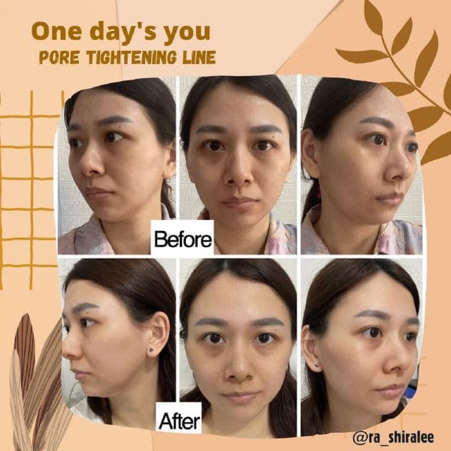 One-day's you Pore Tightening Toner review photo by shiralee
