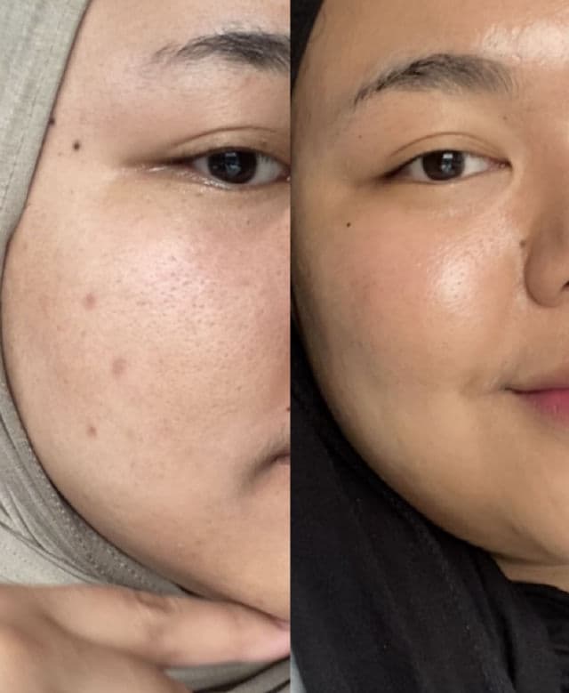 It Cosmetics Bye Bye Dark Spots Niacinamide Serum review photo by Nadasushi
