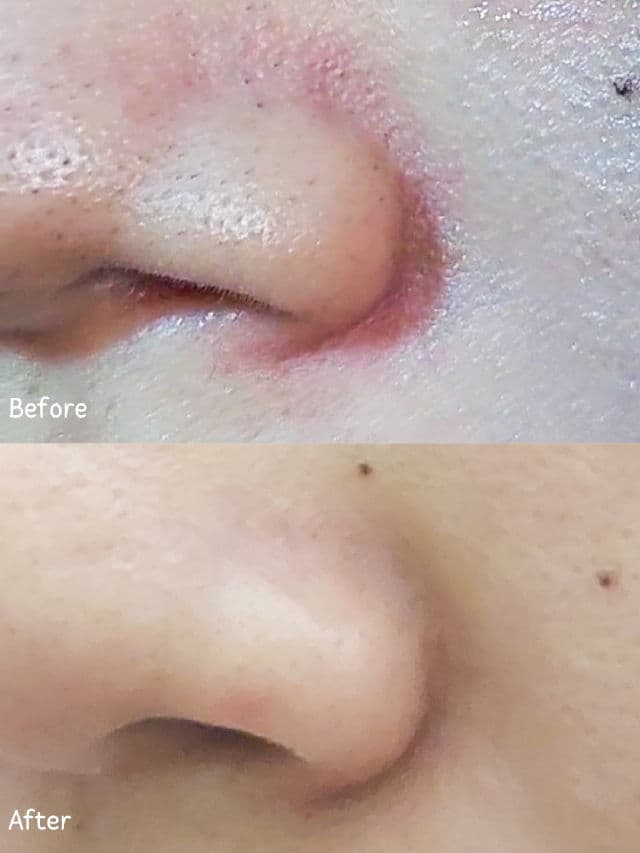 ISNTREE Chestnut BHA 0.9% Clear Liquid review photo by yulianahaa