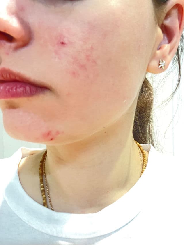 Sunday Riley U.F.O. Ultra-Clarifying Face Oil review photo by Marimara