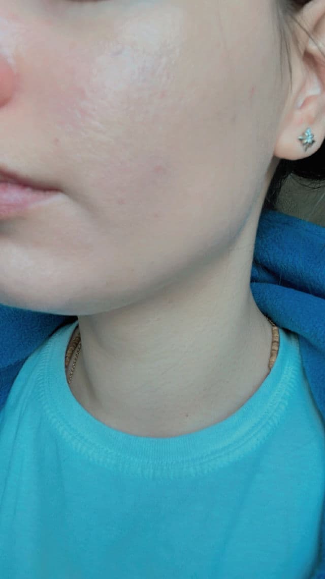 Sunday Riley U.F.O. Ultra-Clarifying Face Oil review photo by Marimara