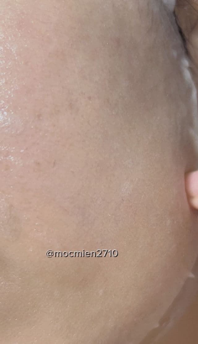 Wonjin Effect Medi Hydro Vial Mask review photo by DiemThi