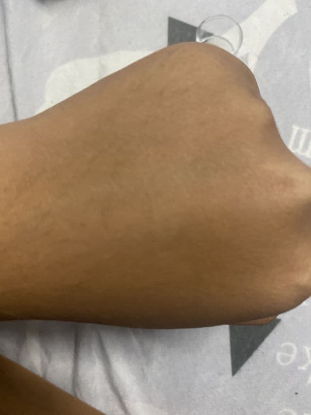 Clinique Dramatically Different™ Oil-Free Gel review photo by Luverlina