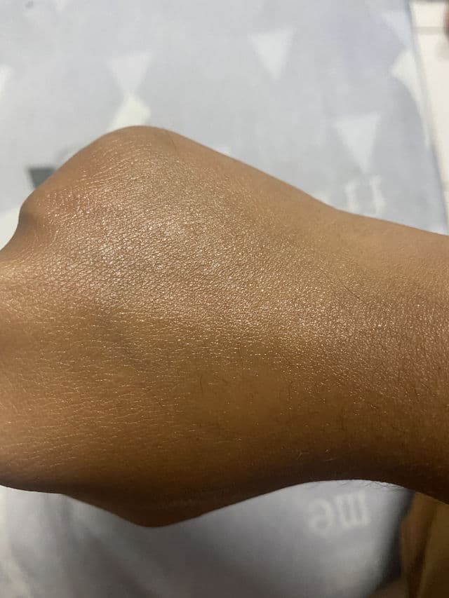 Clinique Dramatically Different™ Oil-Free Gel review photo by Luverlina