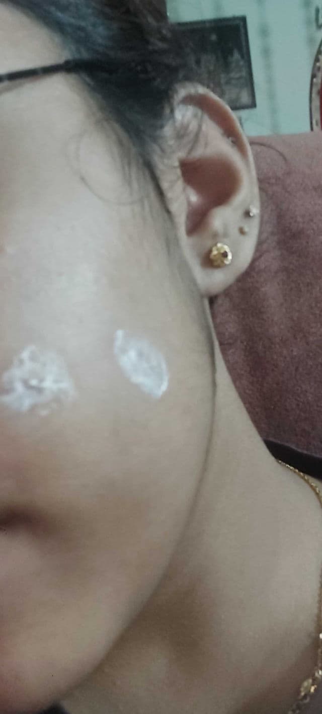 OXY 10 Acne Pimple Medication review photo by LavSha