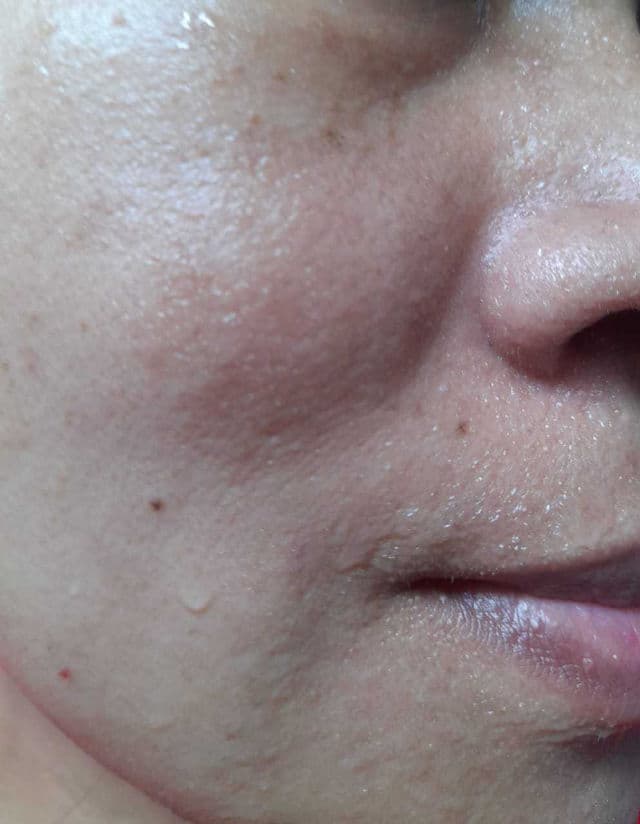 Himalaya Purifying Neem Pack review photo by AidaJune