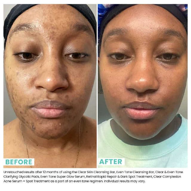 Urban Skin Rx Retinol Rapid Repair & Dark Spot Treatment review photo by Cassidyxo