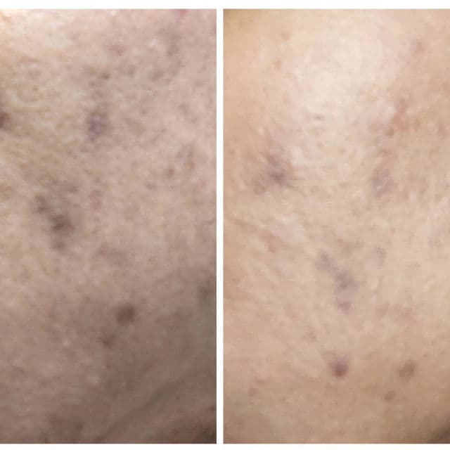 No.5 Glutathione Vitamin C Concentrated Serum product review
