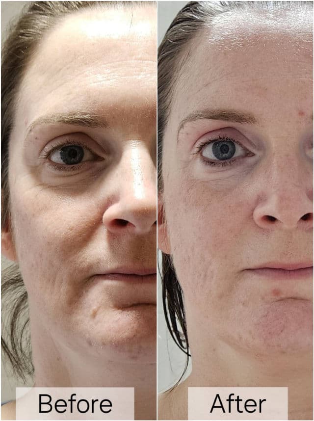 The Inkey List Bio-Active Ceramide Repairing and Plumping Moisturizer review photo by ReviewedbyHanna