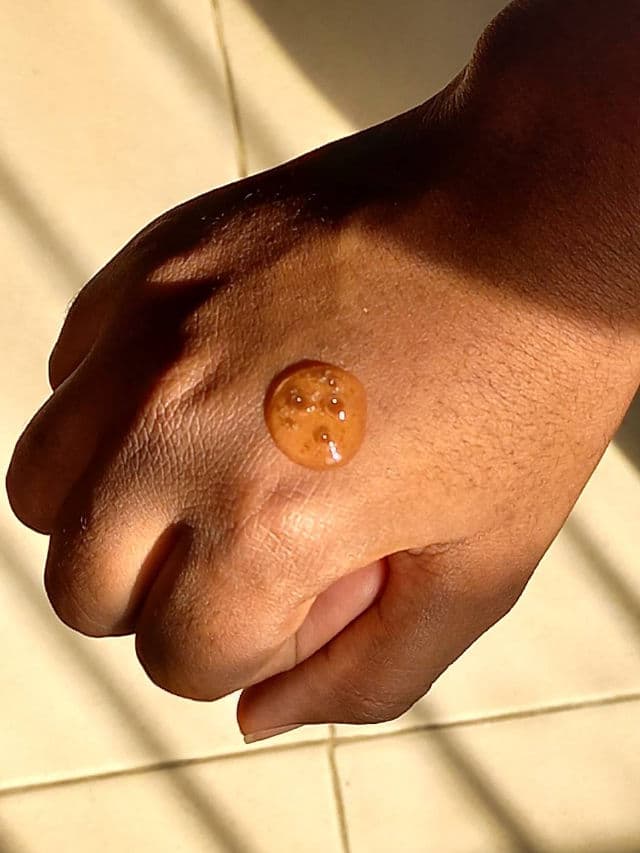 Dr.Rashel Vitamin C Serum review photo by Theskincareintrovert