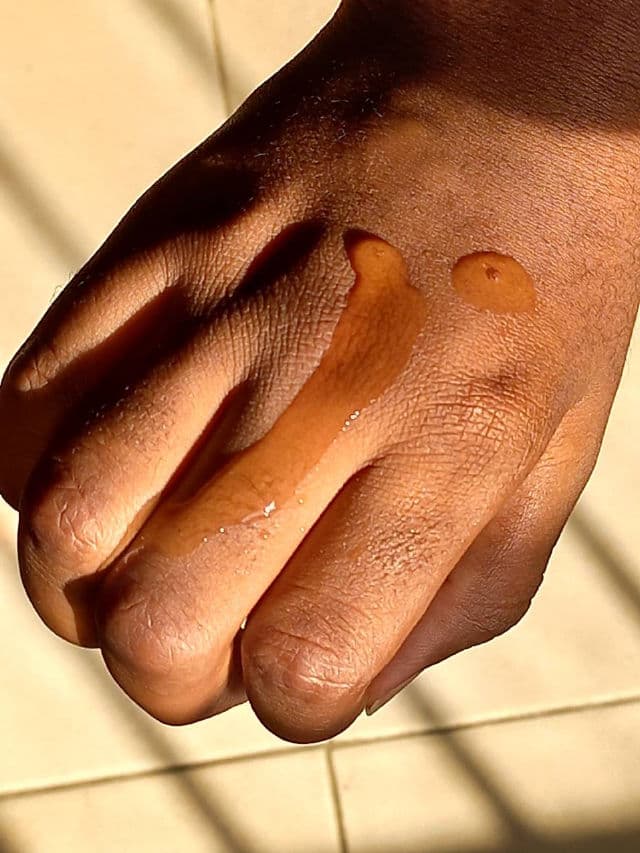Dr.Rashel Vitamin C Serum review photo by Theskincareintrovert