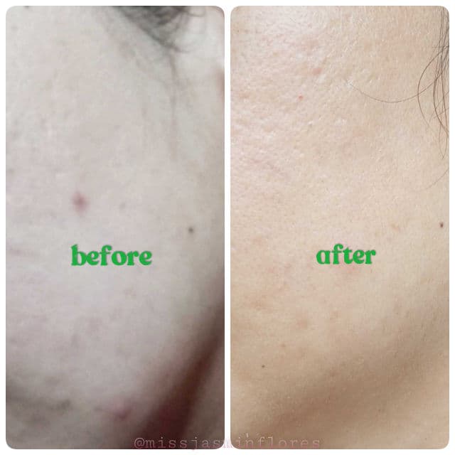 Vegan Gel Cleanser product review
