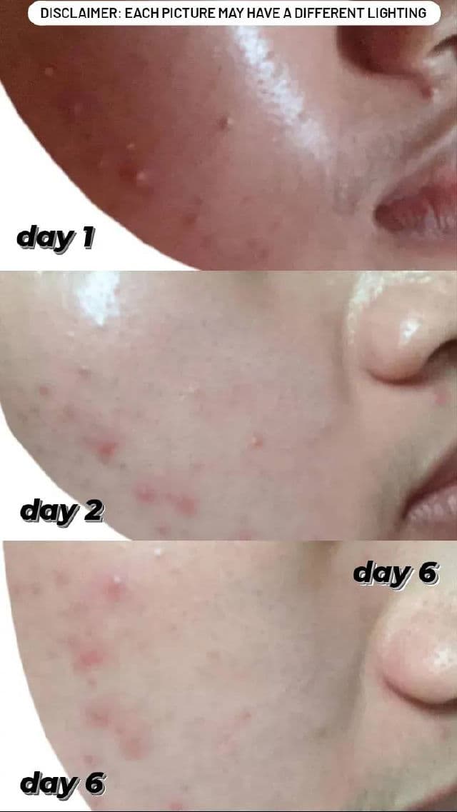 The Pastels Shop "SA" 2% Salicylic Acid Serum review photo by nrzlkha