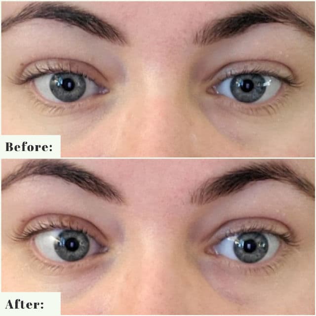 BeautyBio Bright Eyes Collagen-Infused Brightening Colloidal Silver Eye Masks review photo by SmeagolsSister