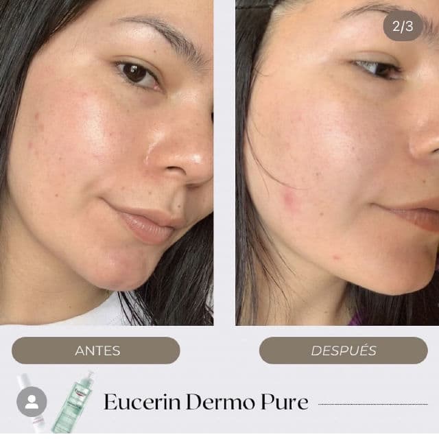Eucerin Dermopure Cleansing Gel review photo by rbkdevelasco