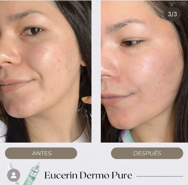 Eucerin Dermopure Cleansing Gel review photo by rbkdevelasco