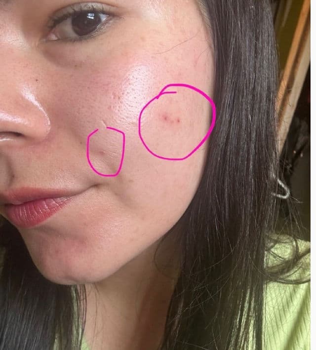 Kiehl's Truly Targeted Acne-Clearing Solution with Salicylic Acid review photo by rbkdevelasco