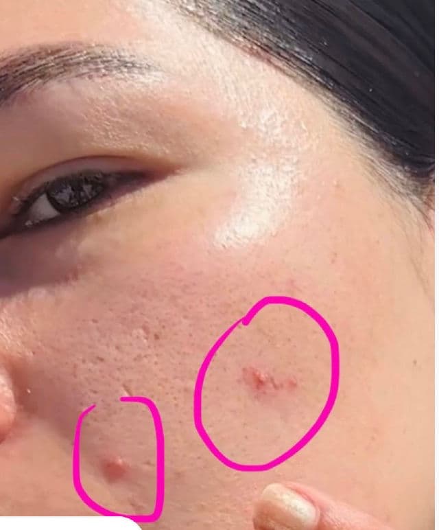 Truly Targeted Acne-Clearing Solution with Salicylic Acid product review