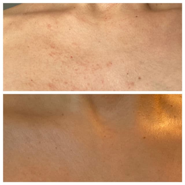 Tata Harper Radiance Mask review photo by BeautybyHedy