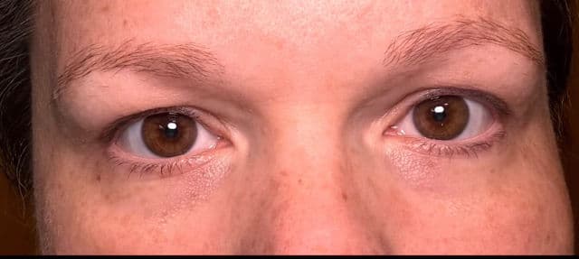 Bright Eyes product review