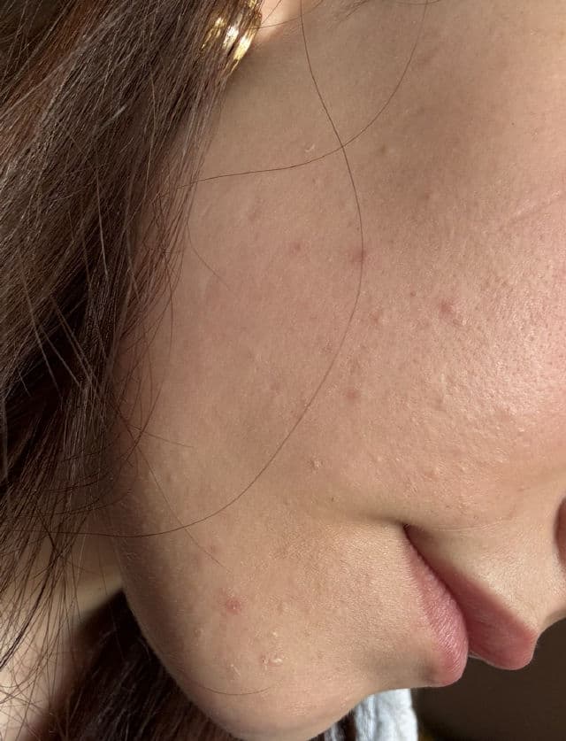 AHA Aqua Peeling Boosting Ampoule product review