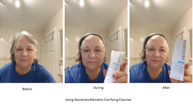 NeoStrata Mandelic Clarifying Cleanser review photo by DesC