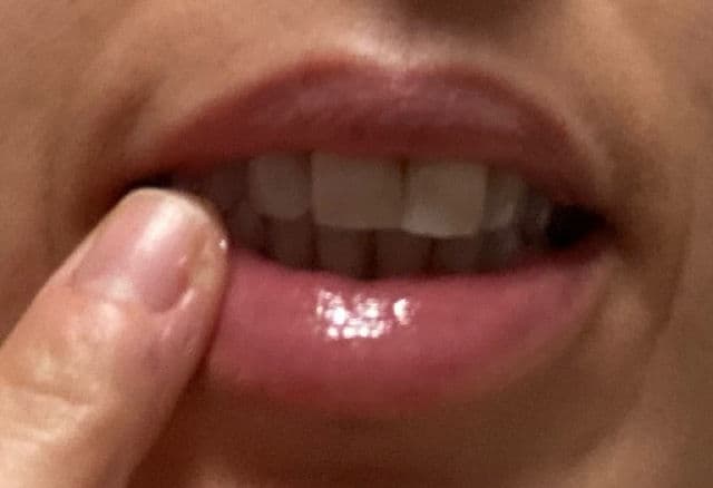 Carmex Watermelon Lip Balm review photo by Morenita1983