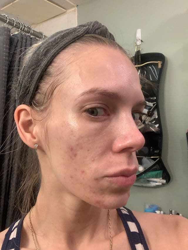 Murad Daily Clarifying Peel review photo by ReneeEgan