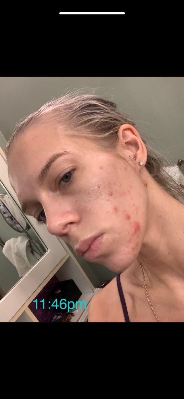 Murad Daily Clarifying Peel review photo by ReneeEgan