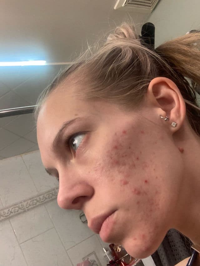 Murad Daily Clarifying Peel review photo by ReneeEgan