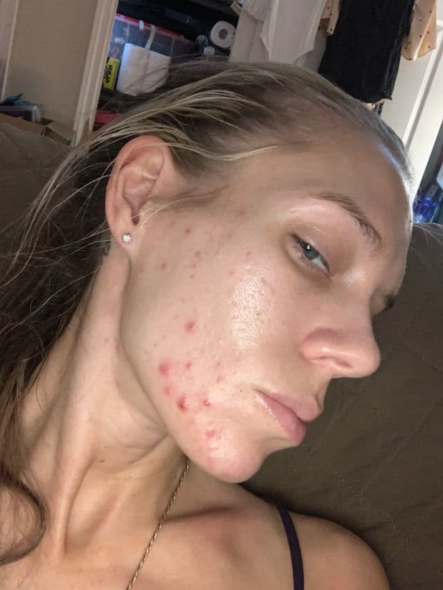Murad Daily Clarifying Peel review photo by ReneeEgan